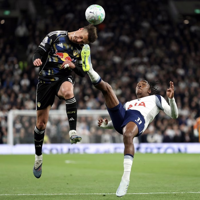 Volante do Leeds mostra ferimento na testa após receber chute de atacante do Tottenham; veja foto