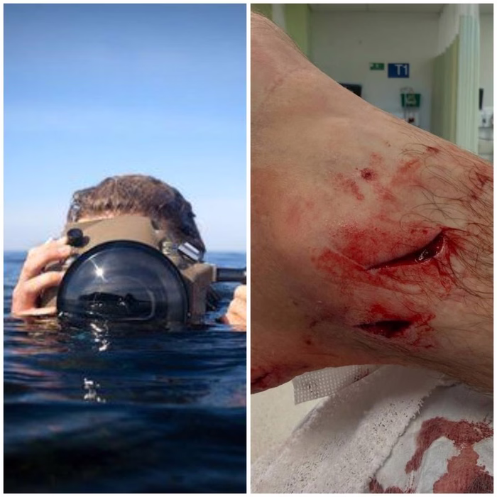 Fotógrafo desabafa sobre ataque de animal em Raglan: "Parece que fui esfaqueado umas seis vezes"