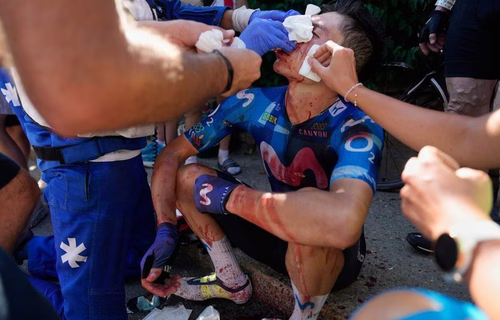 Tour de France 2026 : Vingt points de suture pour Rubio après avoir heurté la vitre d’une voiture dans l’Alpe d’Huez