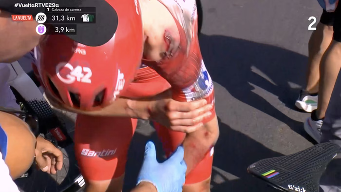 Pogacar stürzt bei der Vuelta: Fleischwunde zwingt Weltmeister zur Aufgabe
